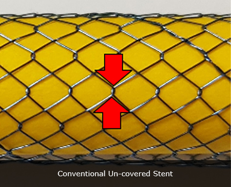 Conventional Un-covered Stent